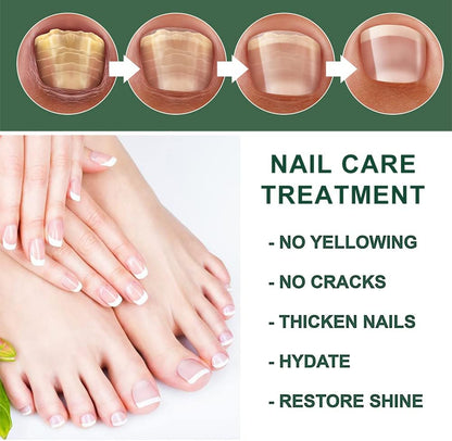 Fast Nail Fungus Remover